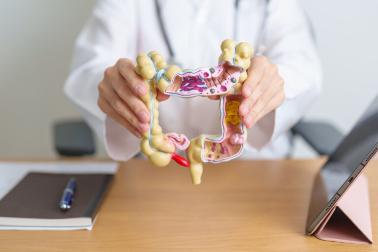 Doctor with Colon model to explain warning signs of ulcerative colitis.